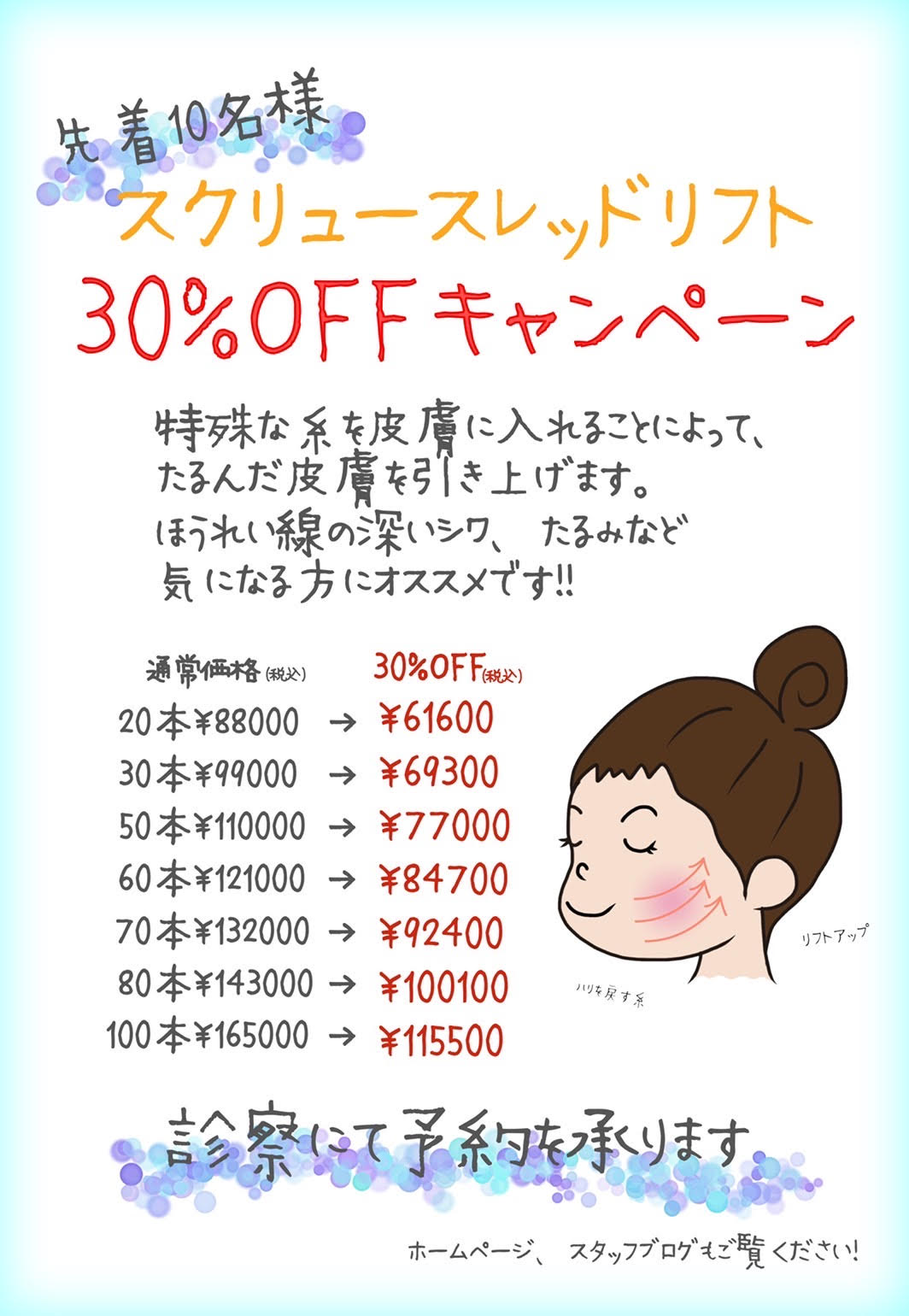 スクリューキャンペーン スクリューキャンペーン